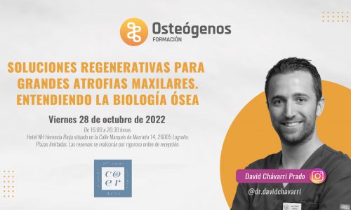 Soluciones regenerativas para grandes atrofias maxilares | 28 de Octubre en Logroño
