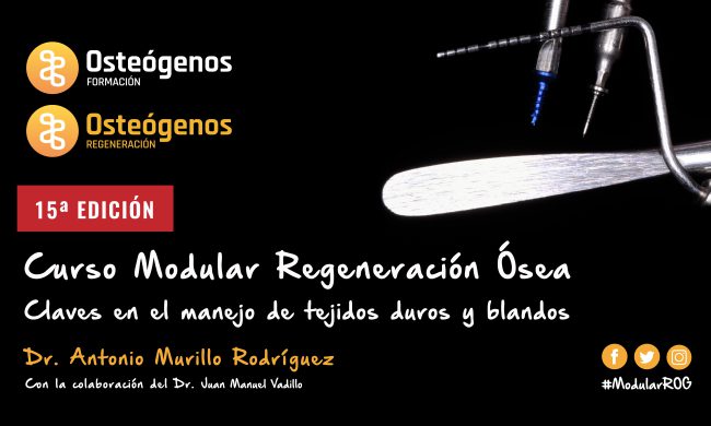 Modular regeneración ósea | 2024 Madrid