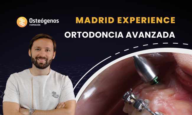 Ortodoncia avanzada – Madrid Experience 2024
