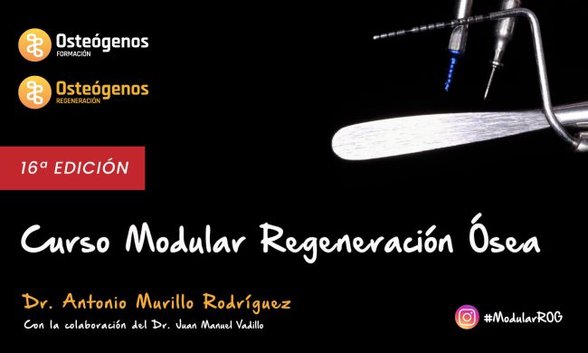 Modular regeneración ósea | 2025 Madrid