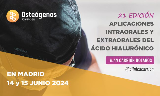 Aplicaciones intraorales y extraorales del ácido hialurónico  | 14 y 15 de junio en Madrid