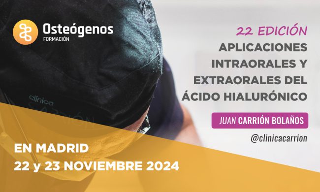 Aplicaciones intraorales y extraorales del ácido hialurónico  | 22 y 23 de noviembre en Madrid